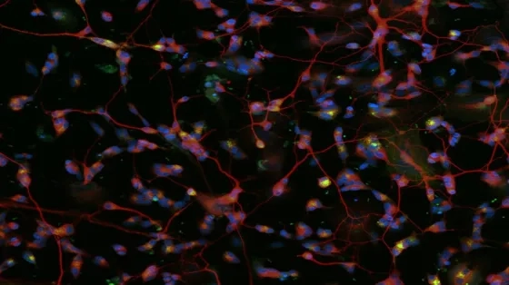 Micrograph of a kind of neuron expressing a synthetic fluorescent protein that helps to measure when the pH level of a lysosome is declining.